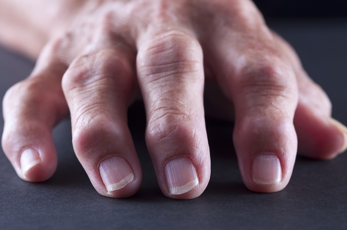 Selective-focus image of Arthritic/Senior Adult Hands shot on black table