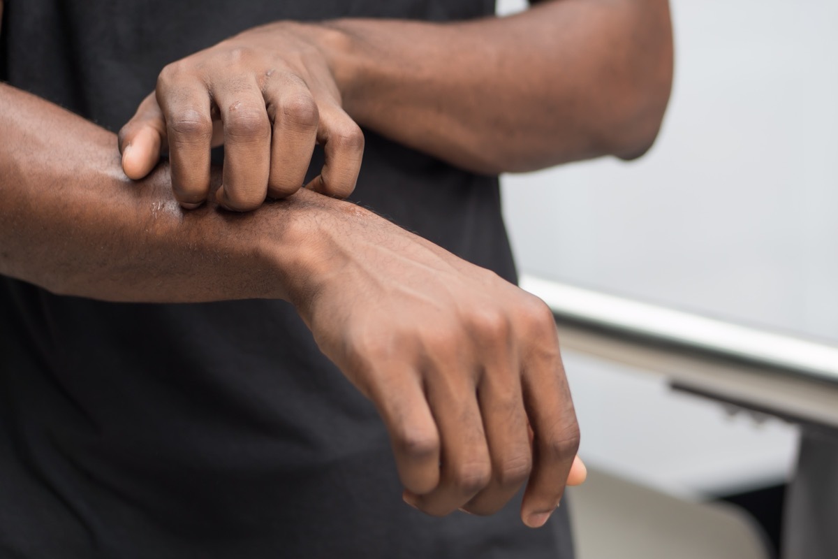 black man itches arm, only arms are shown