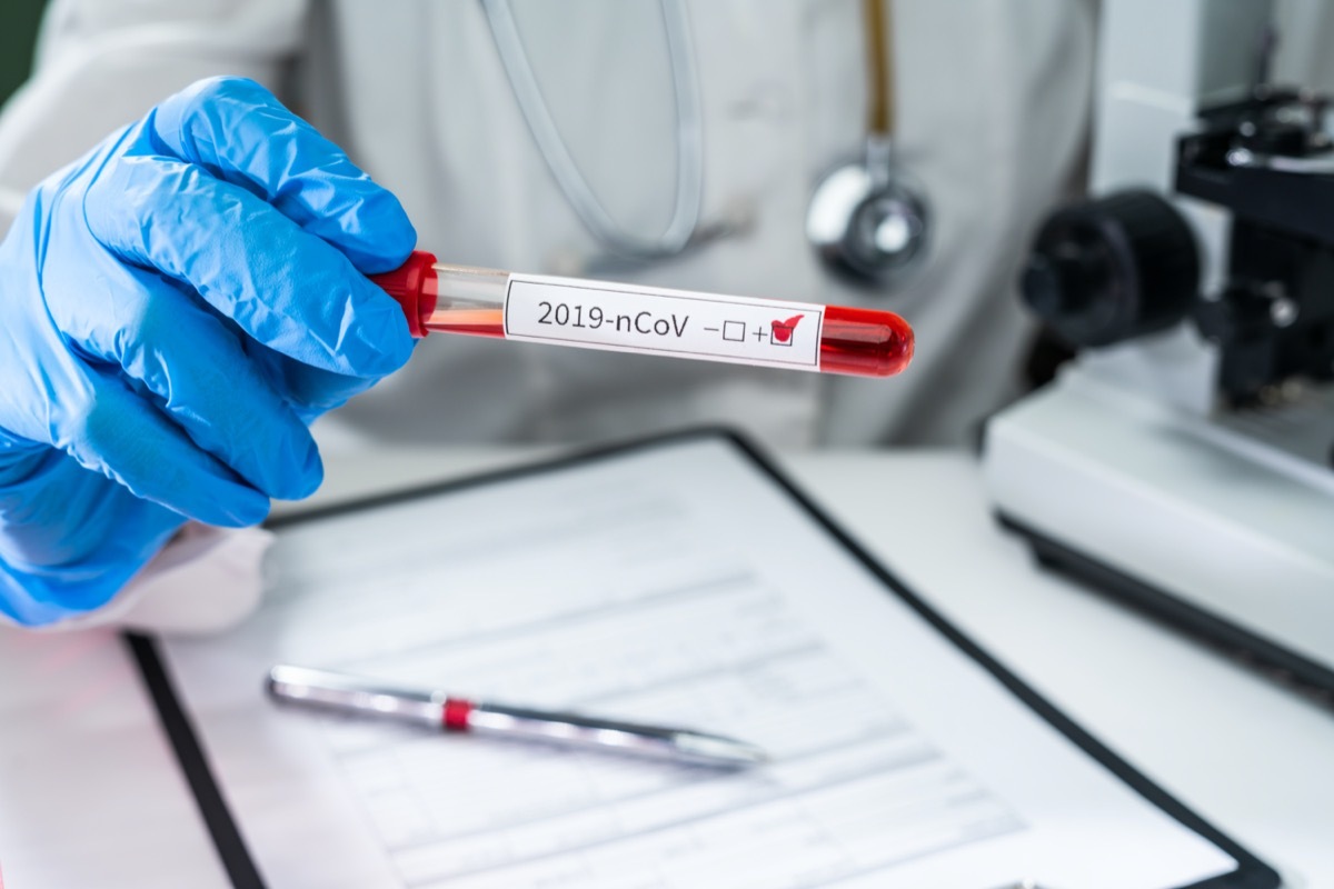 gloved hands holding covid blood test