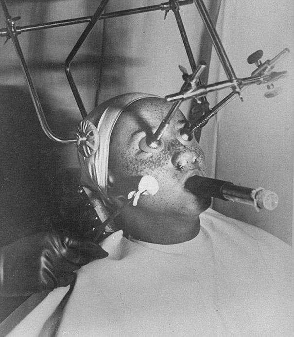 weirdest_beauty_salon_procedures_from_the_past_06