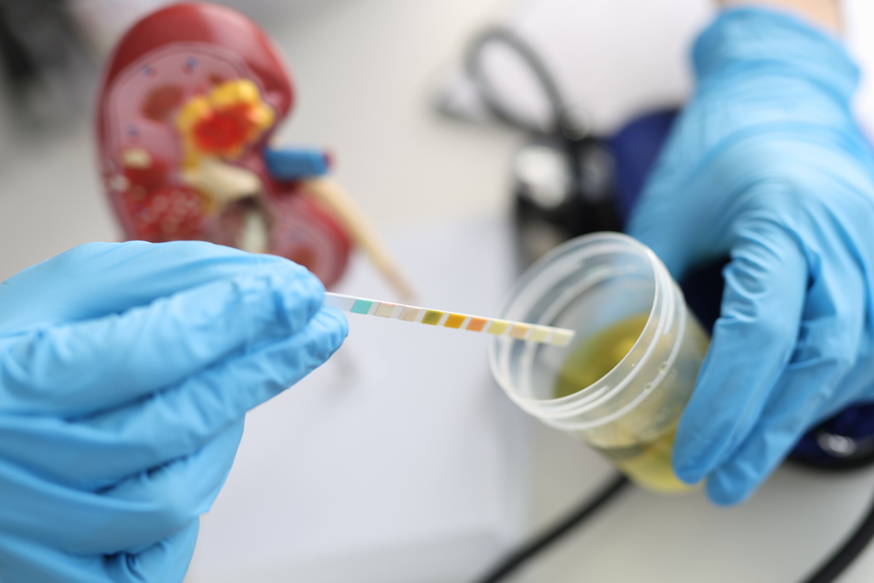 Doctor testing urine from a cup. 