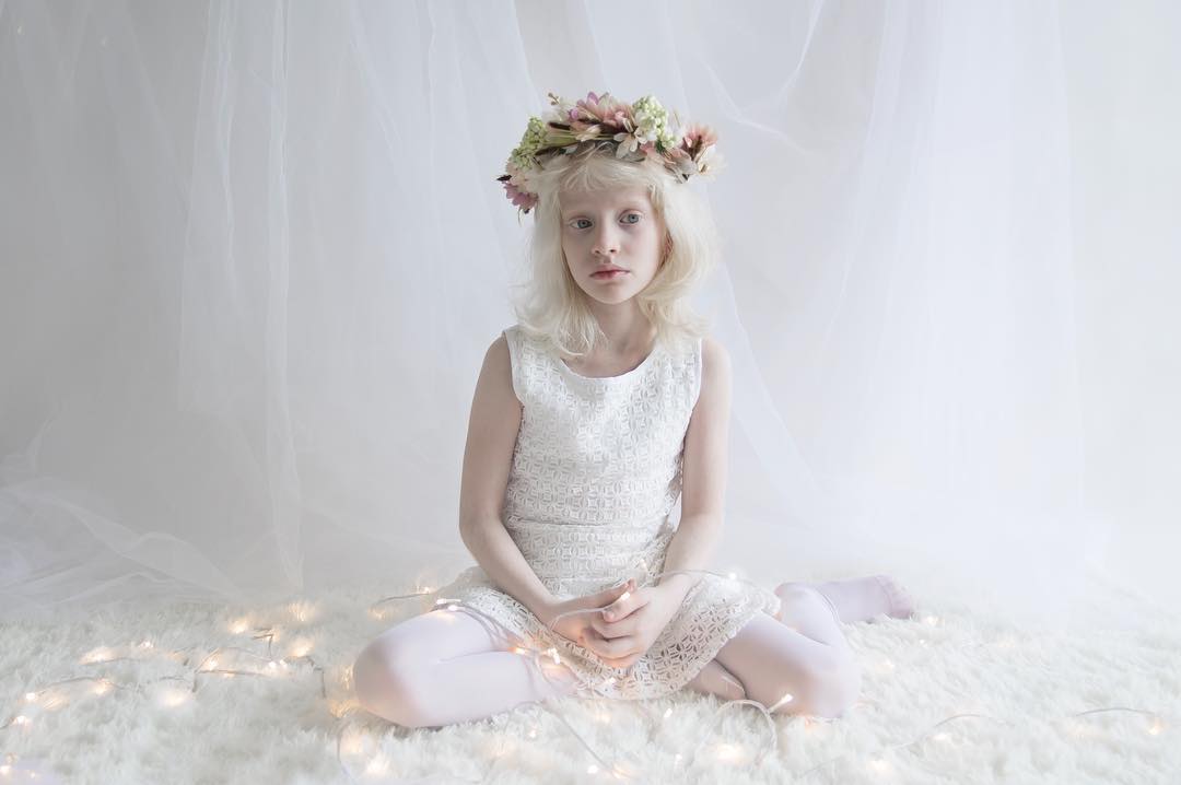 breathtaking-beauty-of-albinos-was-captured-by-a-photographer-10