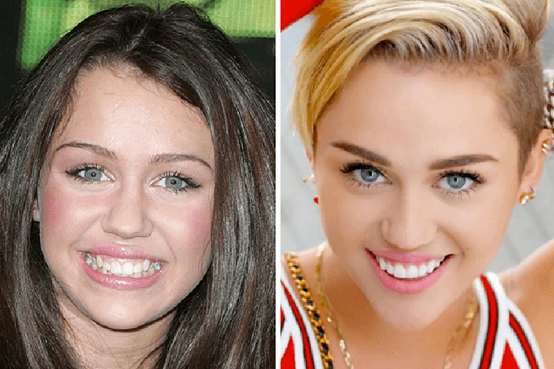 12-celebrity-transformations-that-have-baffled-millions-of-fans8