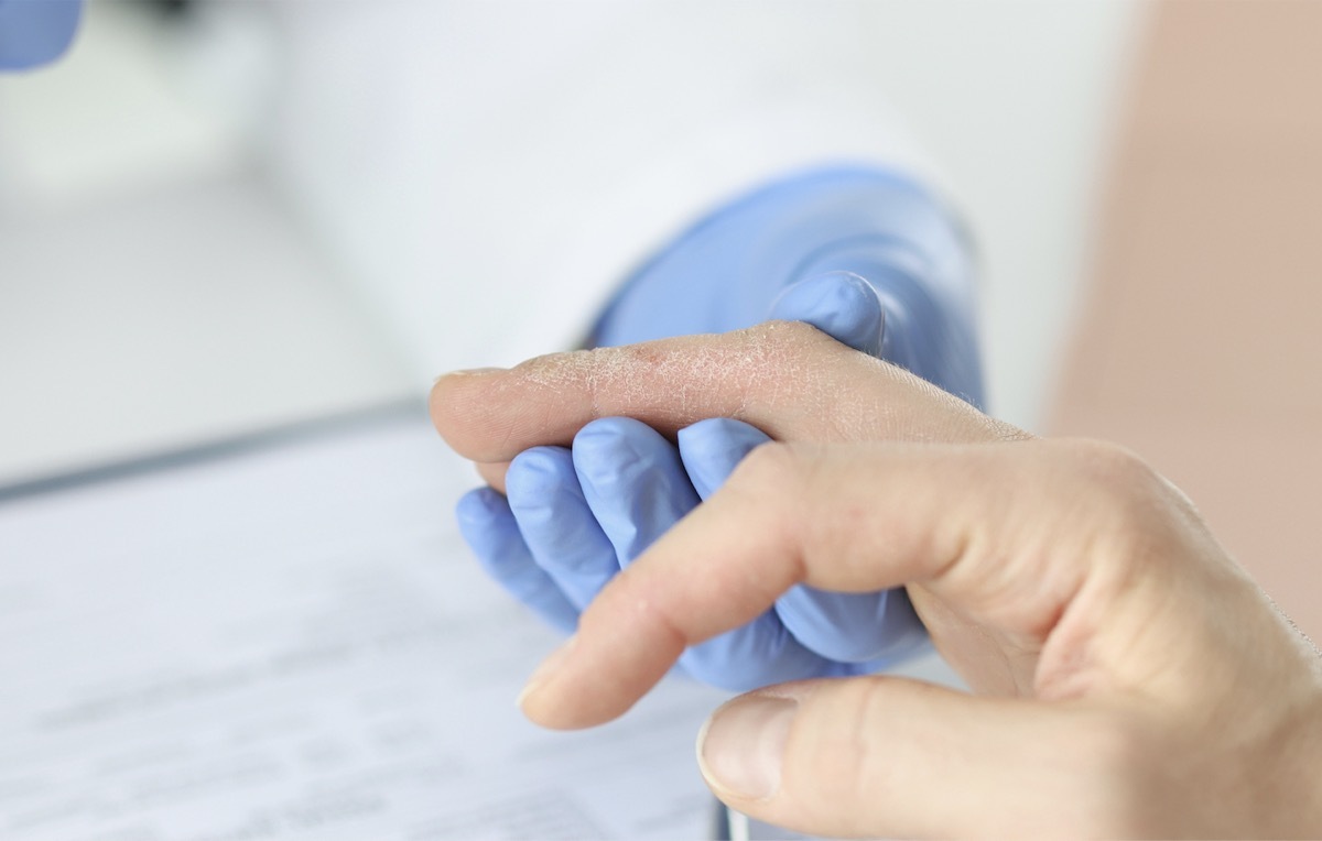 Doctor looking at fingers