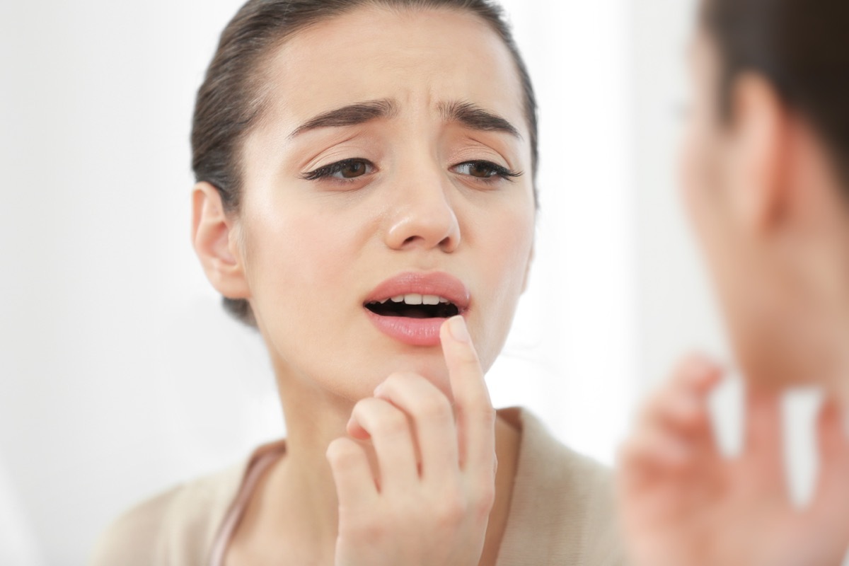 Woman putting cream on her dry lips