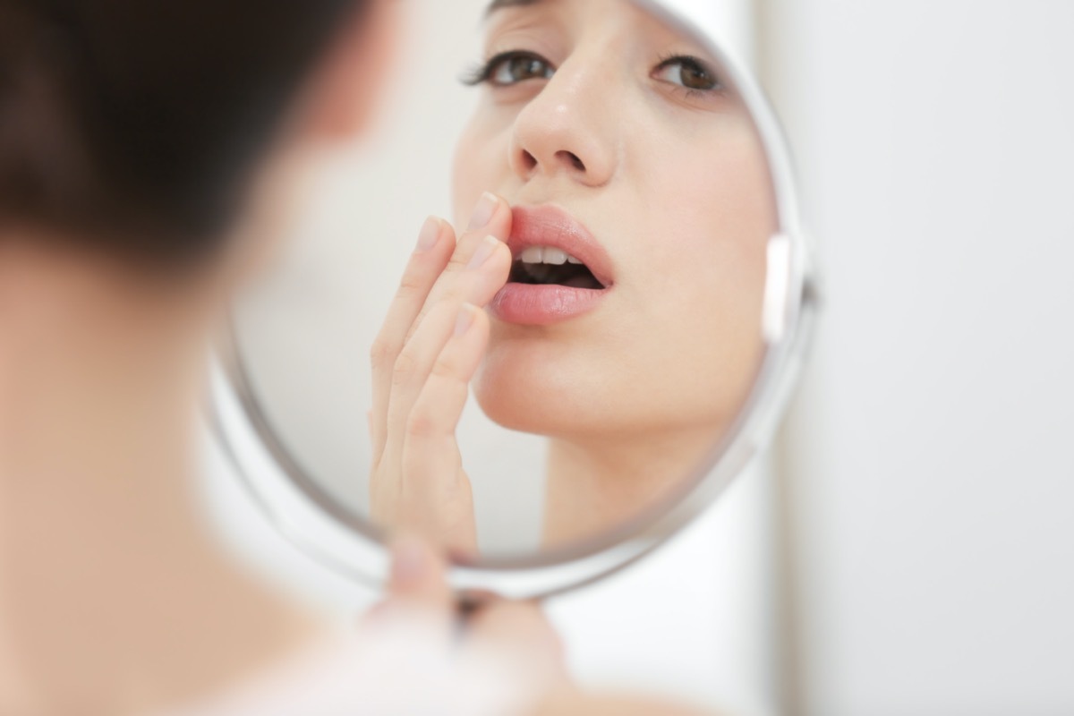 woman with cold sore looking in mirror at home