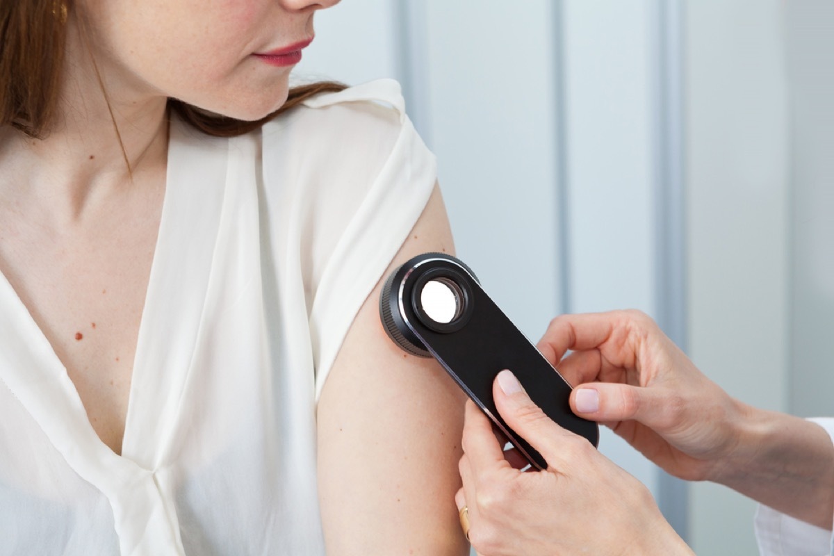 woman getting mole checked at the dermatologist, hand sanitizer germs