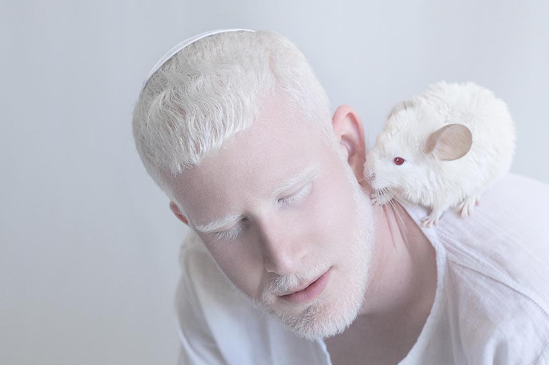 breathtaking-beauty-of-albinos-was-captured-by-a-photographer-03